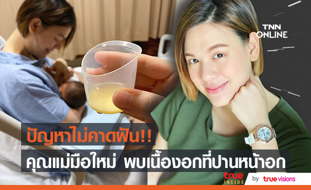 "เกล รดา" เจอปัญหาไม่คาดฝันหลังพบเนื้องอก ที่ปานหน้าอก 