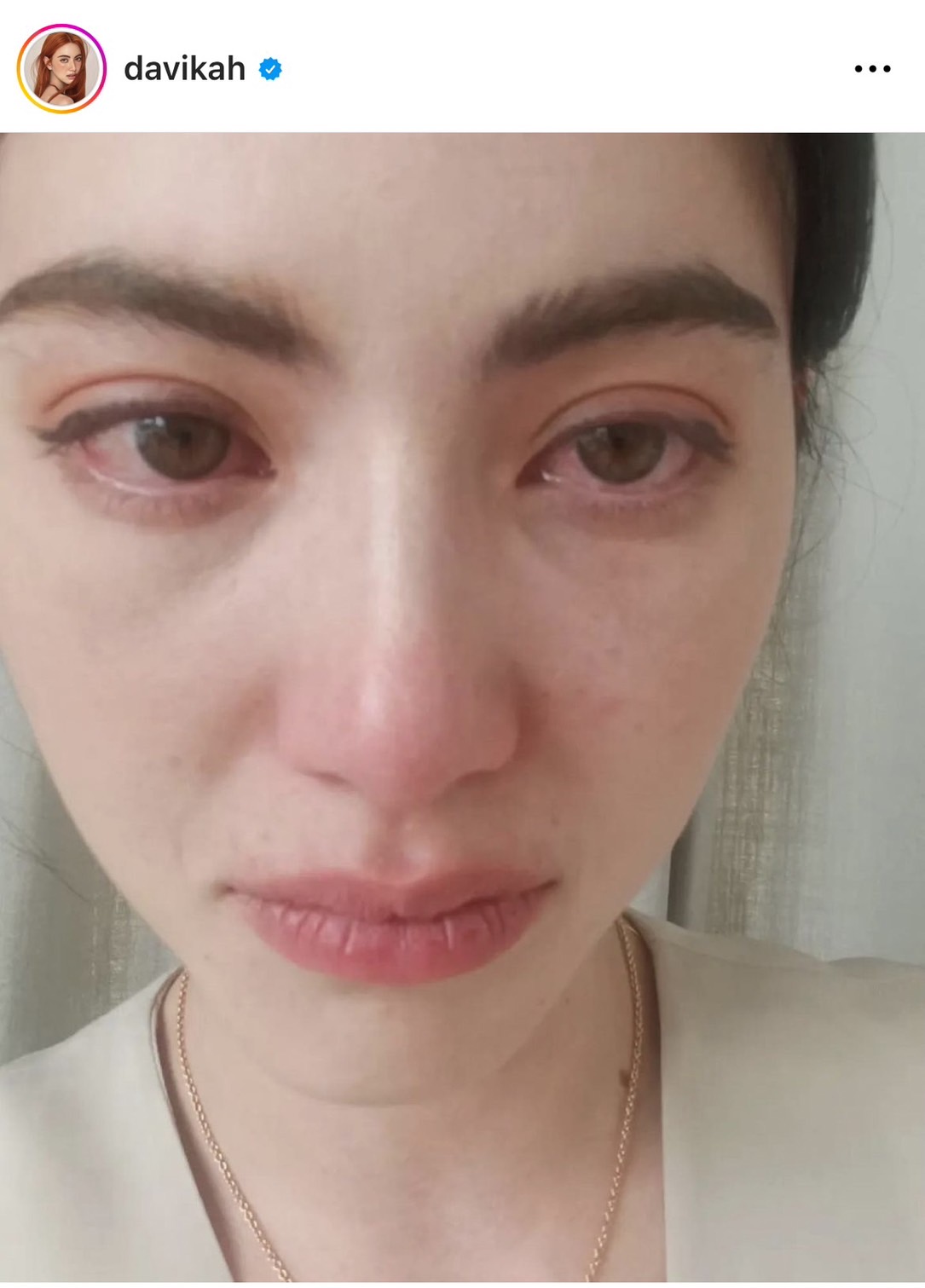 ใหม่ ดาวิกา เผยสาเหตุผอมจนเห็นกระดูก ลั่นฝากบอกคนที่เข้าใจผิดด้วย 