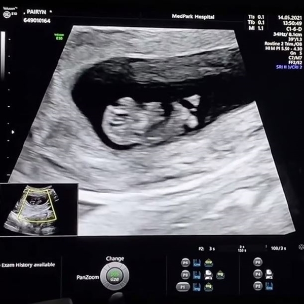 แต๊งค์ พงศกร จดทะเบียนสมรสกับแฟนสาว ส่วนงานแต่งขอให้พ้นช่วโควิดไปก่อน