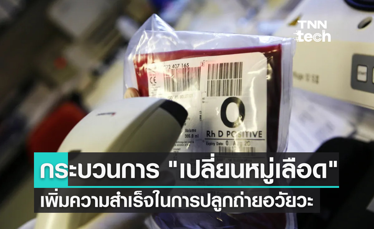 กระบวนการ "เปลี่ยนหมู่เลือด" เพิ่มความสำเร็จในการปลูกถ่ายอวัยวะ