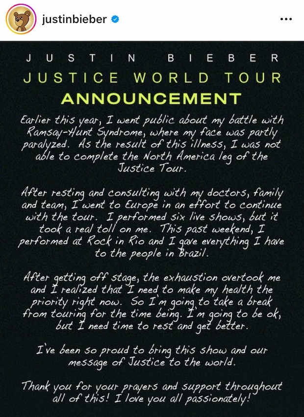 ยกเลิกทัวร์คอนเสิร์ตที่เหลือ!! ‘จัสติน บีเบอร์’ ขอโฟกัสเรื่องสุขภาพก่อนอย่างอื่น ยกเลิกทัวร์คอนเสิร์ตที่เหลือ!! ‘จัสติน บีเบอร์’ ขอโฟกัสเรื่องสุขภาพก่อนอย่างอื่น