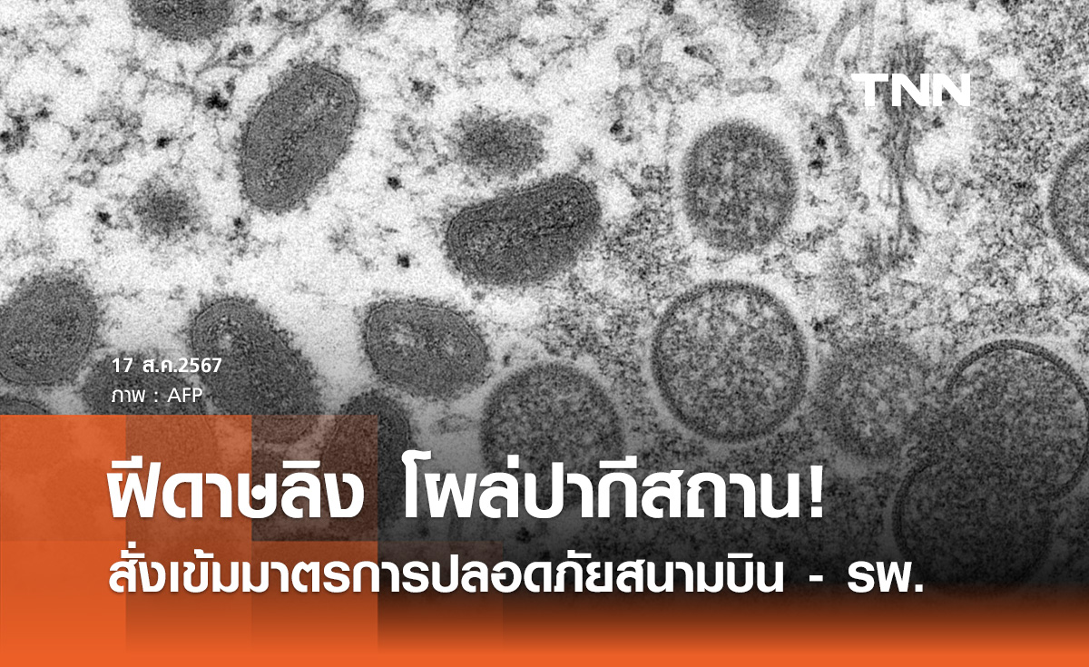 ปากีสถาน เพิ่มมาตรการปลอดภัย หลังพบผู้ป่วย ‘ฝีดาษลิง’ รายแรก