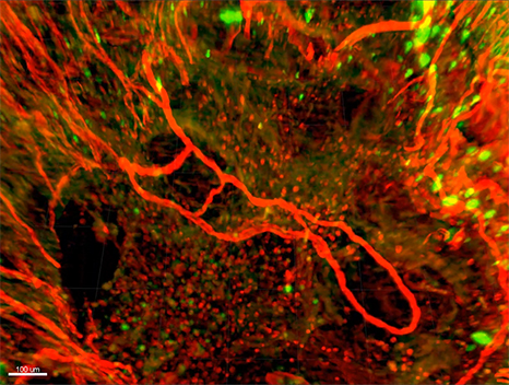 นักวิจัยค้นพบวิธีฟื้นฟูสมองบาดเจ็บ ด้วยไฮโดรเจล (Hydrogel) นักวิจัยค้นพบวิธีฟื้นฟูสมองบาดเจ็บ ด้วยไฮโดรเจล (Hydrogel)