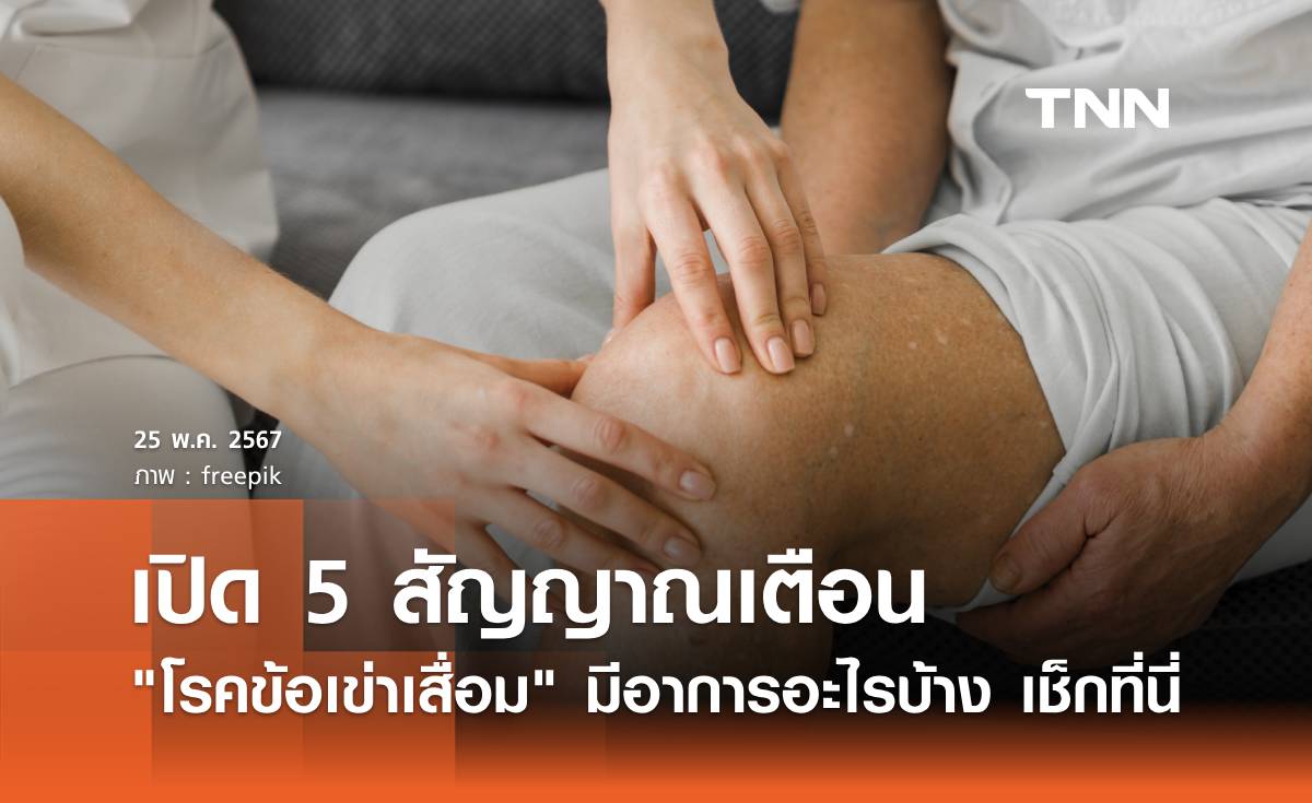 5 สัญญาณเตือน "โรคข้อเข่าเสื่อม" มีอาการอะไรบ้าง เช็กได้ที่นี่