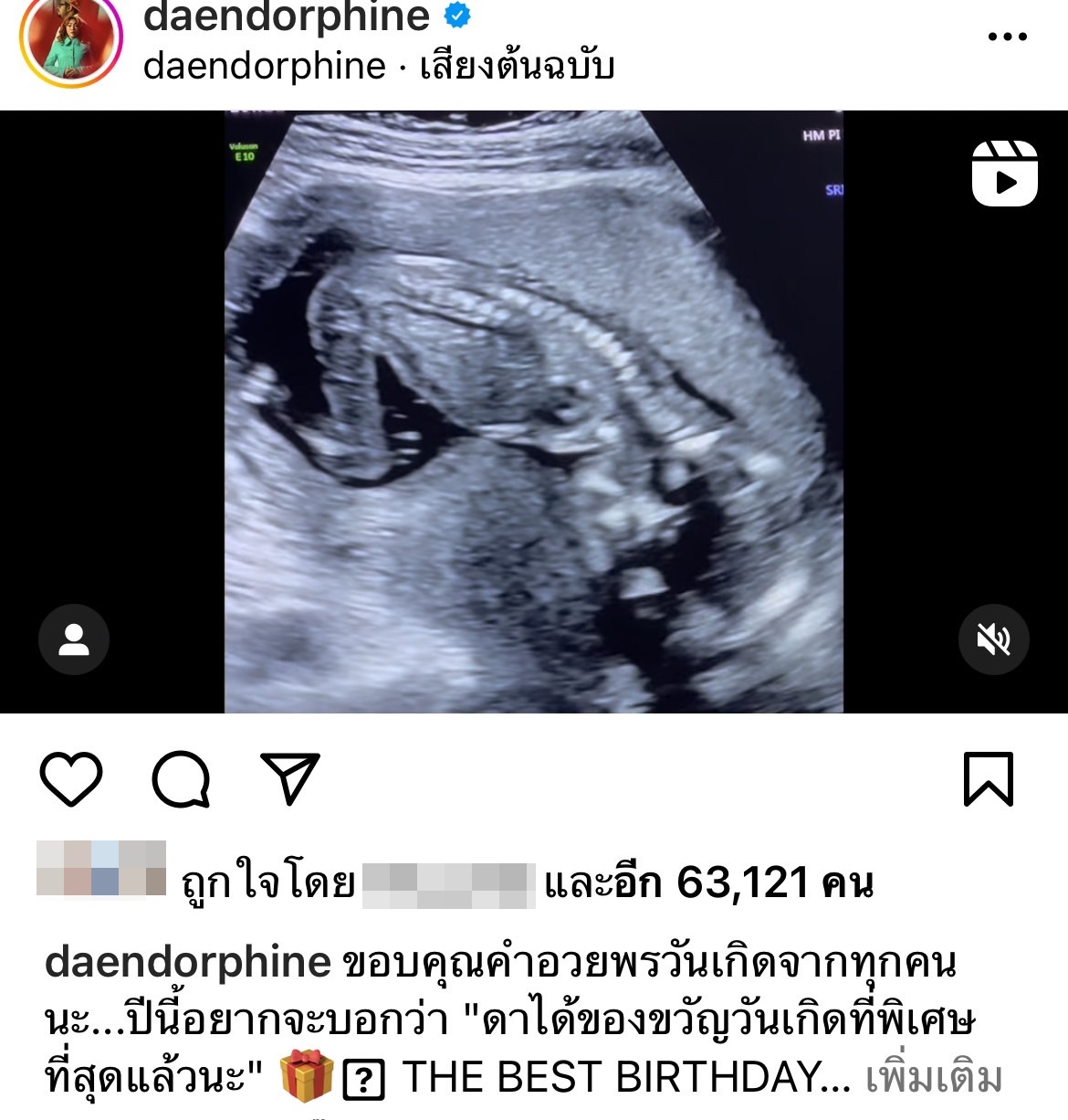 ดา เอ็นโดรฟิน เผยความรู้สึก หลังตั้งท้องลูกคนแรกได้ 4 เดือน ดา เอ็นโดรฟิน เผยความรู้สึก หลังตั้งท้องลูกคนแรกได้ 4 เดือน