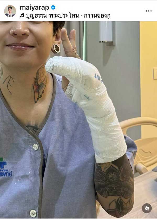 แชมป์ ไมยราพ แร็ปเปอร์ดัง กระดูกมือแตก เพื่อนศิลปินแห่ส่งกำลังใจ แชมป์ ไมยราพ แร็ปเปอร์ดัง กระดูกมือแตก เพื่อนศิลปินแห่ส่งกำลังใจ