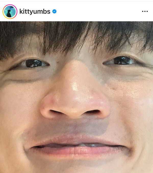 กิต Three Man Down พักงานด่วน! จอประสาทตาอักเสบ สูญเสียการมองเห็น กิต Three Man Down พักงานด่วน! จอประสาทตาอักเสบ สูญเสียการมองเห็น