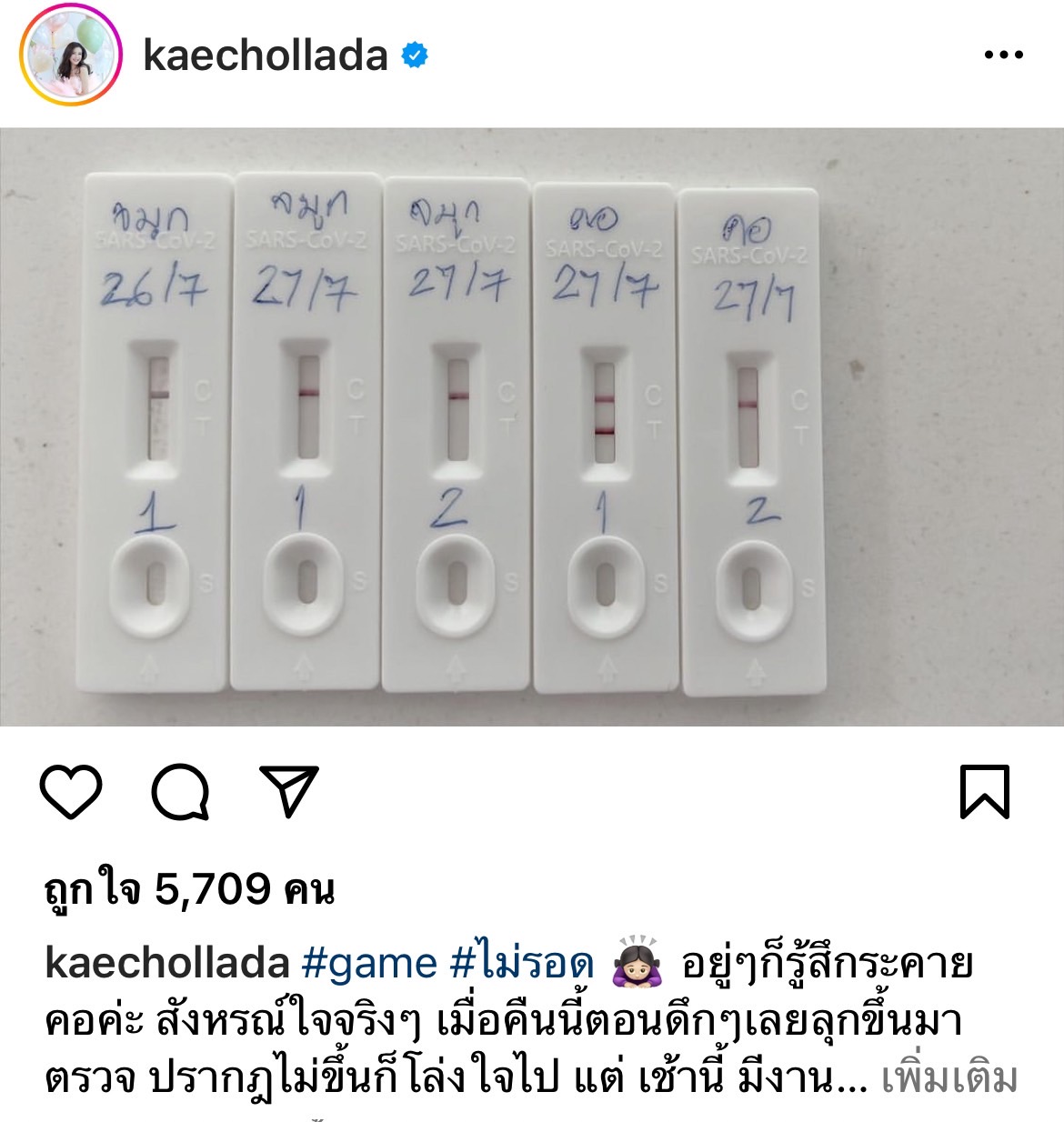 ติดโควิด!! เก๋ ชลลดา ยกเลิกงานด่วน ด้าน ปุ๊ อัญชลี กักตัวที่โรงพยาบาล โชคดีเชื้อไม่ลงปอด ติดโควิด!! เก๋ ชลลดา ยกเลิกงานด่วน ด้าน ปุ๊ อัญชลี กักตัวที่โรงพยาบาล โชคดีเชื้อไม่ลงปอด