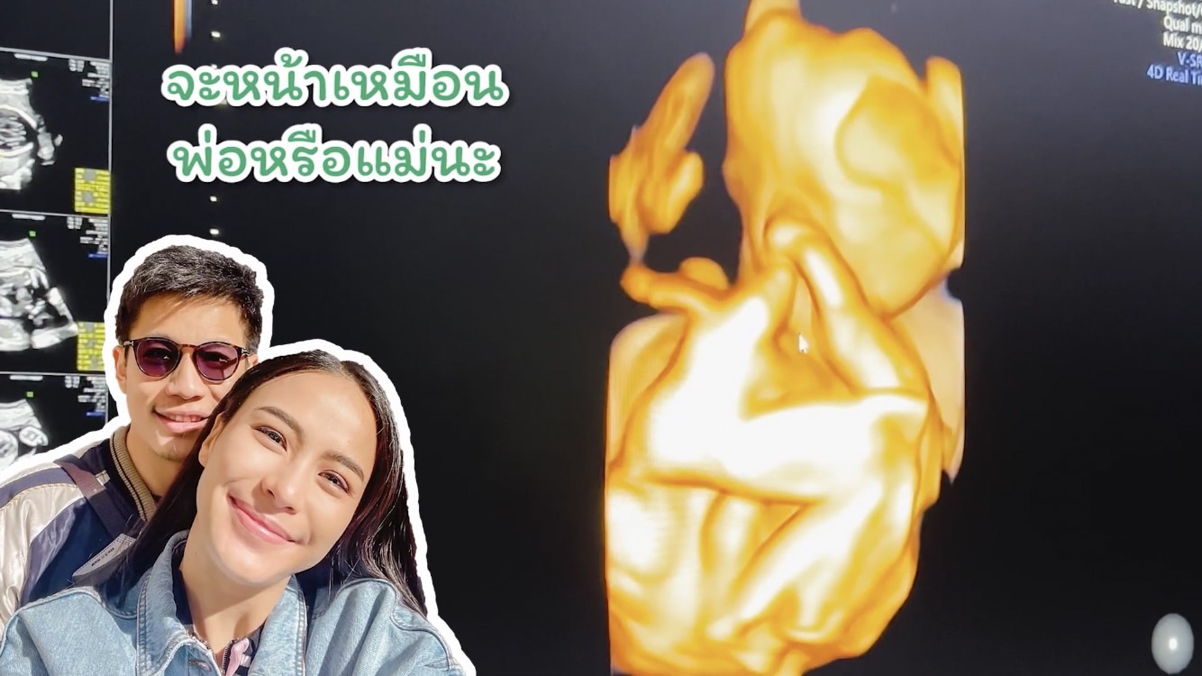 ได้รู้สักที รถเมล์ คะนึงนิจ ยอมเฉลยเพศของลูกแล้ว หลังอุบมานาน