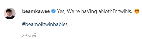 เปิดใจ บีม กวี ว่าที่คุณพ่อลูก 4 ยลโฉมเบบี๋ฝาแฝดท้อง 2 เผย ภรรยา แพ้ท้องหนัก