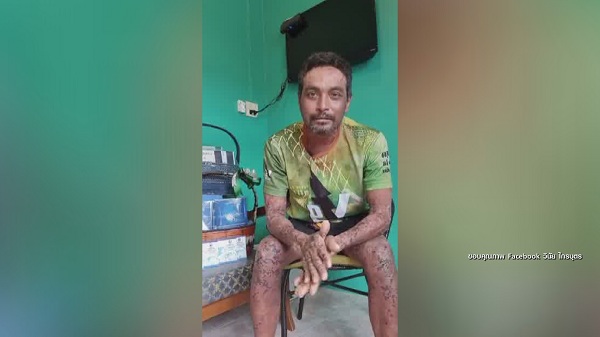 “เมฆ วินัย” น้ำตาคลอตัดพ้อ หวังให้มียารักษาโรคตุ่มน้ำพอง (มีคลิป) “เมฆ วินัย” น้ำตาคลอตัดพ้อ หวังให้มียารักษาโรคตุ่มน้ำพอง (มีคลิป)