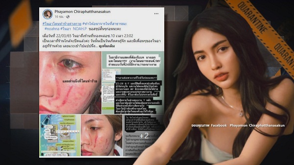 “โนอา” มอบหลักฐานเพิ่มเติมให้ตำรวจ  (มีคลิป)