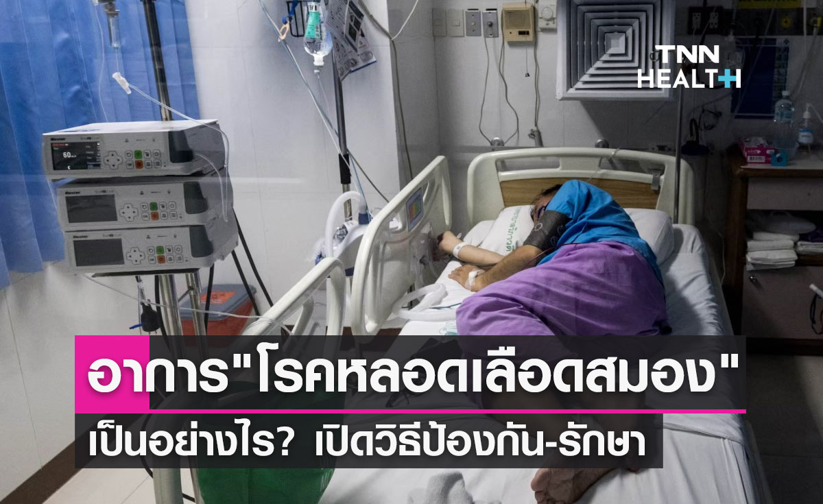 โรคหลอดเลือดสมอง มีอาการอย่างไร? เปิดวิธีป้องกันและการรักษา