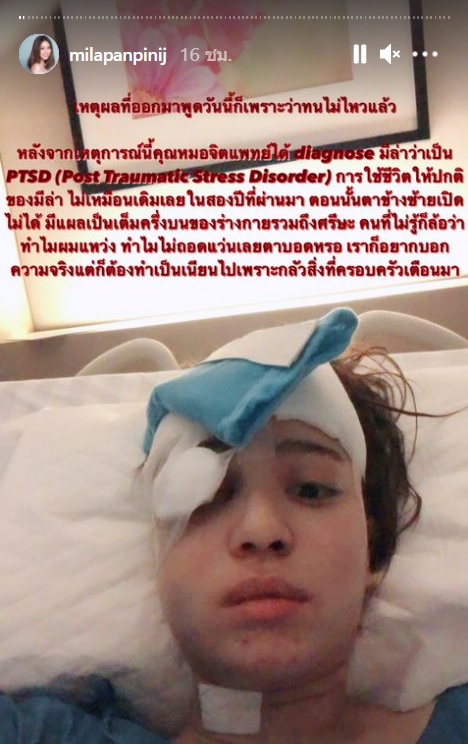 ทำความรู้จัก PTSD คือ โรคอะไร ที่ 'มีล่า Kamikaze' บอกเล่ากำลังเผชิญ