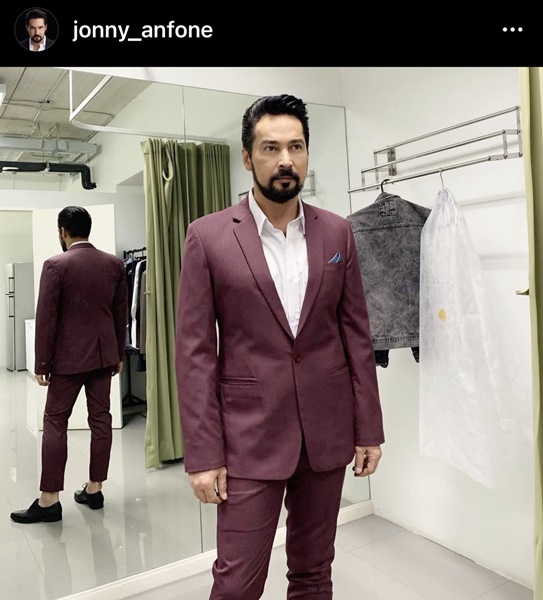 เสริมหล่อ!! จอนนี่ แอนโฟเน่ ทำศัลยกรรมหน้า 3 ส่วน 