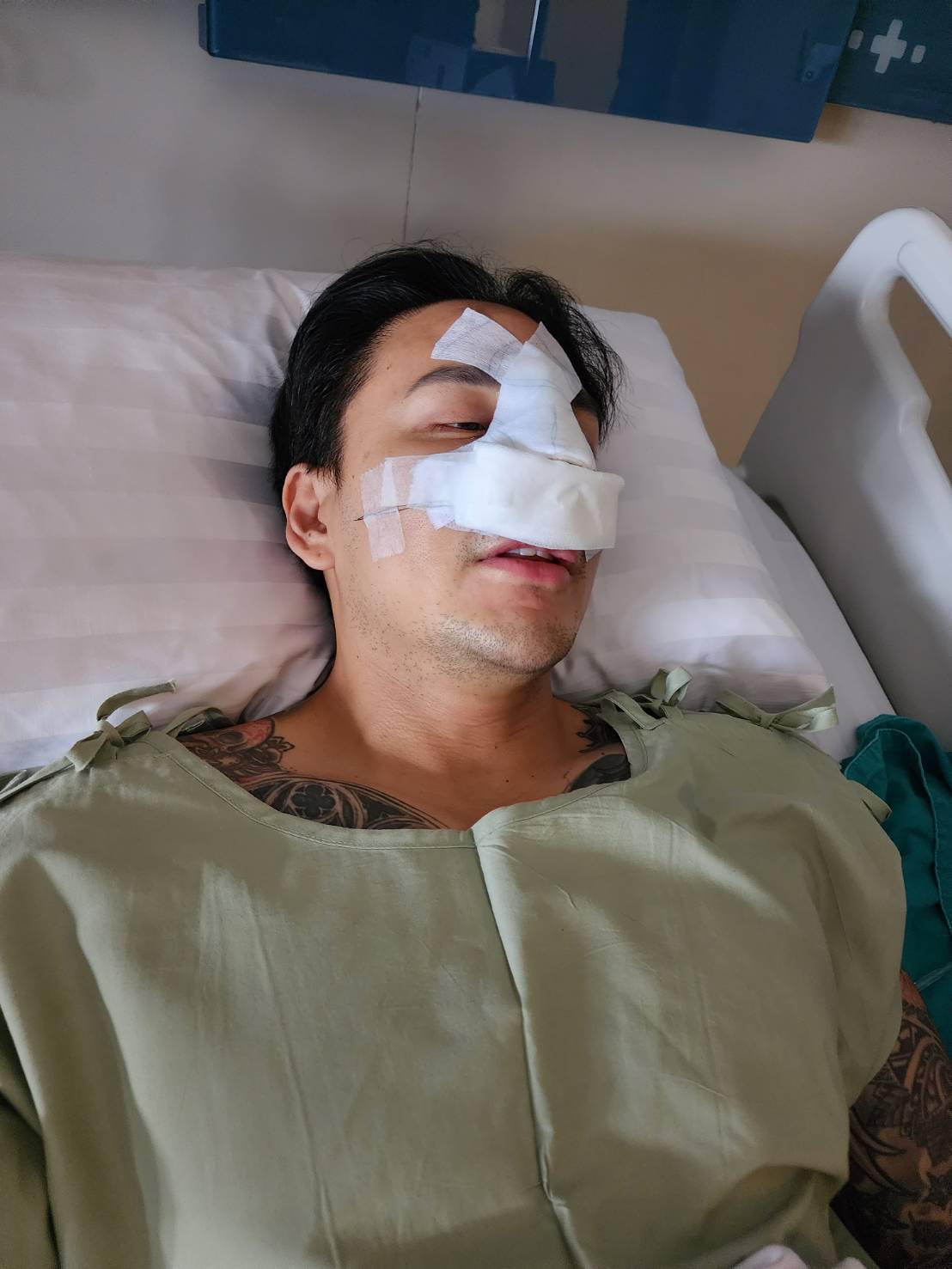 แทค ภรัณยู ออกจากห้องผ่าตัดแล้ว หลังถูกต่อยจมูกหัก แทค ภรัณยู ออกจากห้องผ่าตัดแล้ว หลังถูกต่อยจมูกหัก