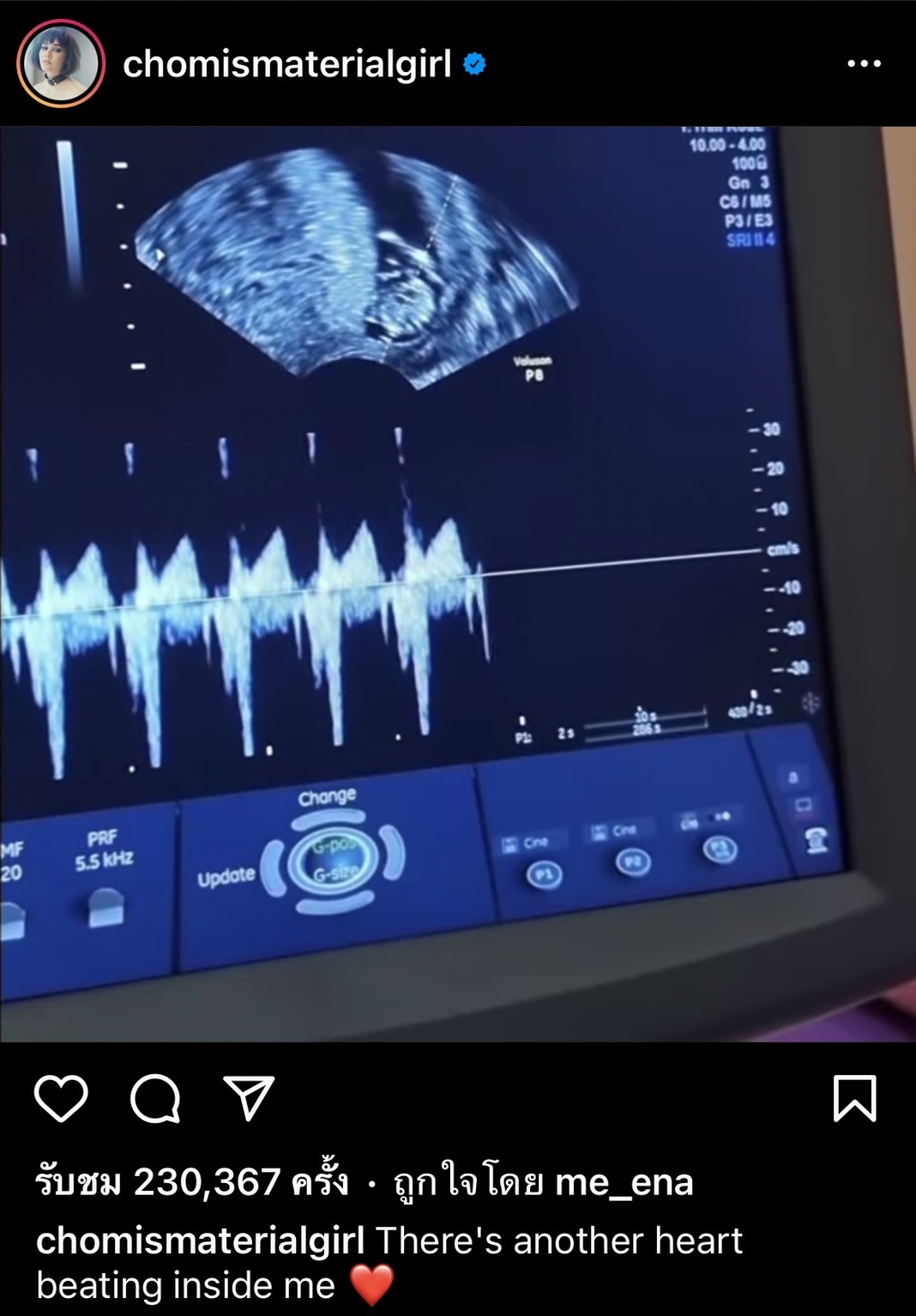 ชมพู่ เผยสาเหตุ ไม่ให้ สายฟ้า - พายุ เรียนออนไลน์และอาจดรอปเรียนไว้ก่อน!! ชมพู่ เผยสาเหตุ ไม่ให้ สายฟ้า - พายุ เรียนออนไลน์และอาจดรอปเรียนไว้ก่อน!!