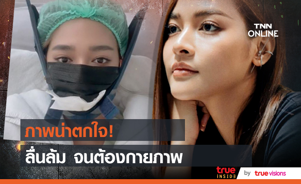 "ปุ๊กลุก ฝนทิพย์"  ลื่นล้มอย่างแรง คอเคล็ดหนัก จนต้องทำกายภาพ