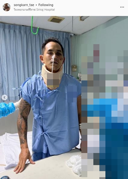 สงกรานต์ กลับบ้านได้เเล้ว หลังประสบอุบัติเหตุบาดเจ็บสาหัส เข้า ICU