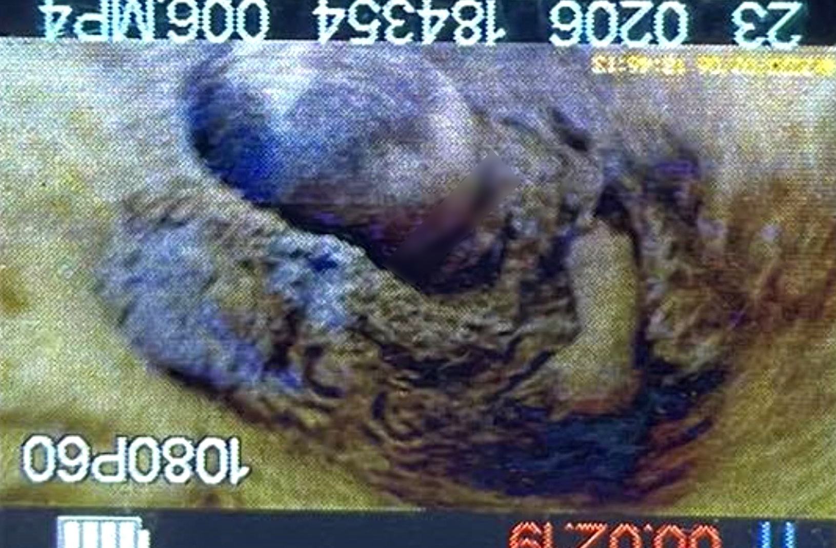 อัปเดต เด็กตกท่อ ลึกกว่า 10 เมตร กู้ภัยขุดดินถึงตัวแล้ว หายใจได้ดี!