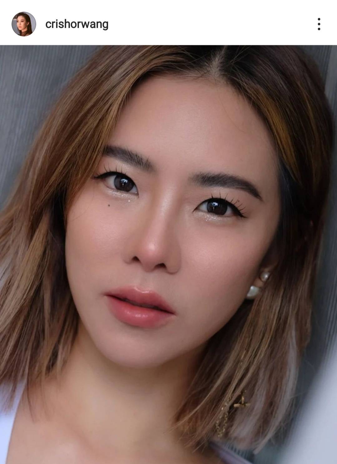 คริส หอวัง เตรียมผ่าตัดหัวเข่า เผย ไม่ต้องห่วง เป็นการผ่าตัดเล็ก คริส หอวัง เตรียมผ่าตัดหัวเข่า เผย ไม่ต้องห่วง เป็นการผ่าตัดเล็ก