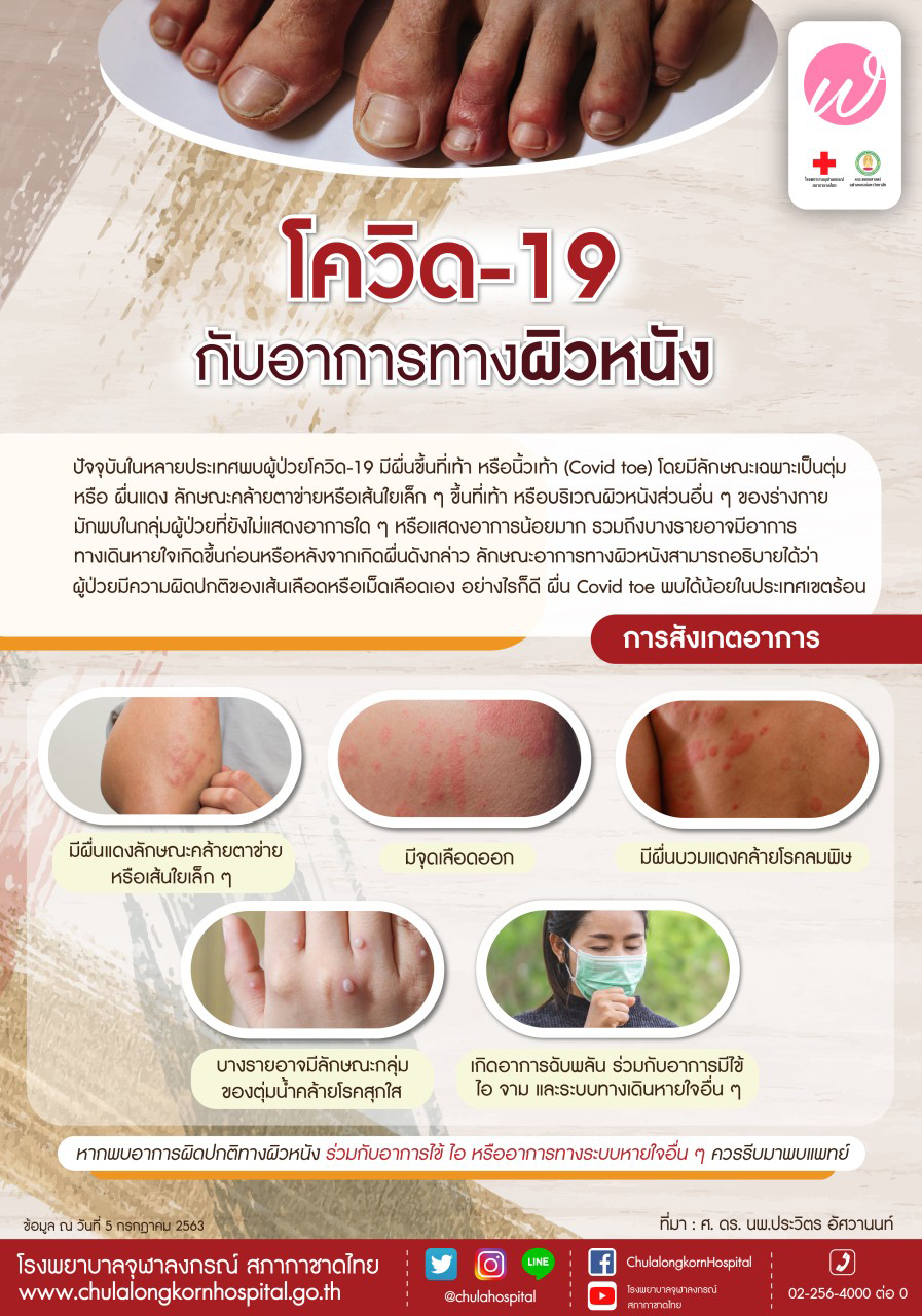 ผื่นแดงโควิด - ผื่นภูมิแพ้ ต่างกันอย่างไร? ผื่นแดงโควิด - ผื่นภูมิแพ้ ต่างกันอย่างไร?